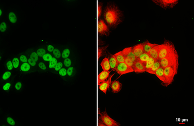 Anti-FOXA1 antibody [HL3168] used in Immunocytochemistry/ Immunofluorescence (ICC/IF). GTX640686