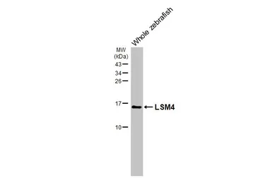 Anti-LSM4 antibody [HL3172] used in Western Blot (WB). GTX640690
