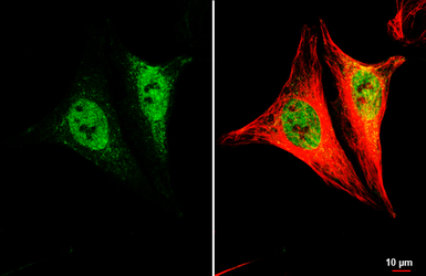 Anti-LSM4 antibody [HL3172] used in Immunocytochemistry/ Immunofluorescence (ICC/IF). GTX640690