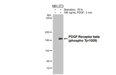 Anti-PDGF Receptor beta (phospho Tyr1009) antibody [HL3174] used in Western Blot (WB). GTX640692