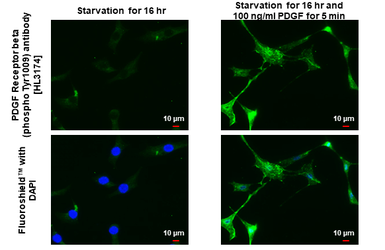 Anti-PDGF Receptor beta (phospho Tyr1009) antibody [HL3174] used in Immunocytochemistry/ Immunofluorescence (ICC/IF). GTX640692