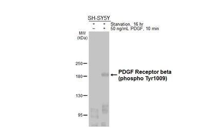 Anti-PDGF Receptor beta (phospho Tyr1009) antibody [HL3174] used in Western Blot (WB). GTX640692