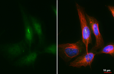 Anti-ARL13B antibody [HL3179] used in Immunocytochemistry/ Immunofluorescence (ICC/IF). GTX640697