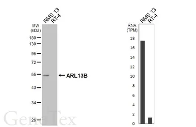 Anti-ARL13B antibody [HL3179] used in Western Blot (WB). GTX640697