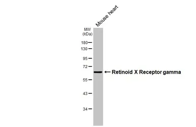 Anti-Retinoid X Receptor gamma antibody [HL3185] used in Western Blot (WB). GTX640824