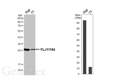 Anti-FLJ11184 antibody [HL3197] used in Western Blot (WB). GTX640837
