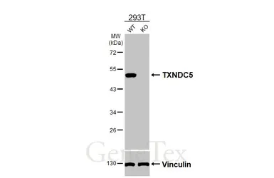 Anti-TXNDC5 antibody [HL3200] used in Western Blot (WB). GTX640840