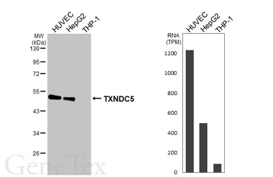 Anti-TXNDC5 antibody [HL3200] used in Western Blot (WB). GTX640840