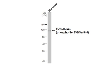 Anti-E-Cadherin (phospho Ser838/Ser840) antibody [HL3201] used in Western Blot (WB). GTX640841