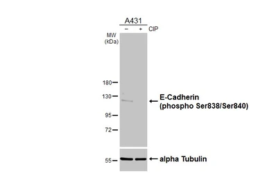 Anti-E-Cadherin (phospho Ser838/Ser840) antibody [HL3201] used in Western Blot (WB). GTX640841