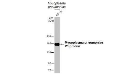 Anti-Mycoplasma pneumoniae P1 protein antibody [HL3203] used in Western Blot (WB). GTX640843