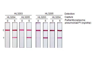 Anti-Mycoplasma pneumoniae P1 protein antibody [HL3203] used in Lateral Flow (Lateral Flow). GTX640843