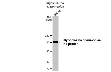 Anti-Mycoplasma pneumoniae P1 protein antibody [HL3204] used in Western Blot (WB). GTX640844