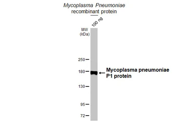 Anti-Mycoplasma pneumoniae P1 protein antibody [HL3205] used in Western Blot (WB). GTX640845