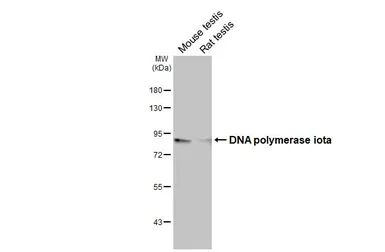 Anti-DNA polymerase iota antibody [HL3209] used in Western Blot (WB). GTX640849