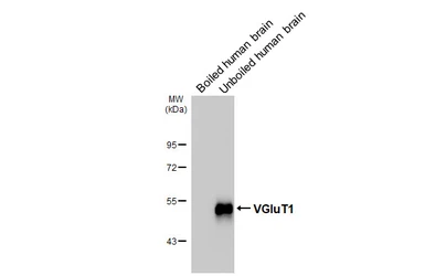 Anti-VGluT1 antibody [HL3210] used in Western Blot (WB). GTX640850