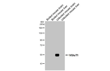 Anti-VGluT1 antibody [HL3210] used in Western Blot (WB). GTX640850