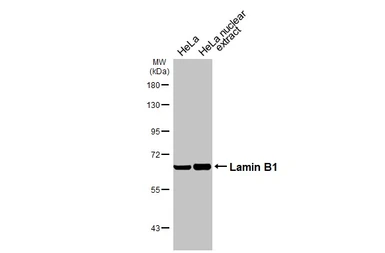 Anti-Lamin B1 antibody [HL3224] used in Western Blot (WB). GTX640865