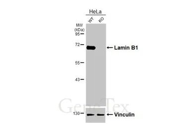 Anti-Lamin B1 antibody [HL3224] used in Western Blot (WB). GTX640865