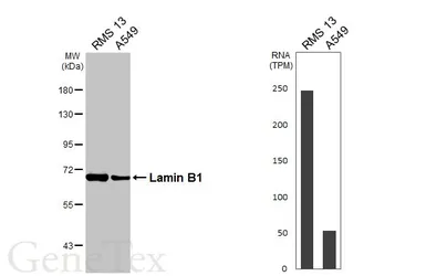Anti-Lamin B1 antibody [HL3224] used in Western Blot (WB). GTX640865