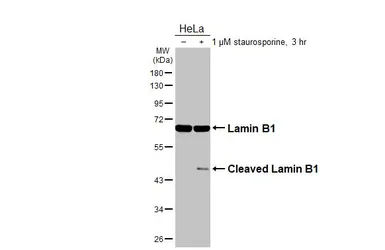 Anti-Lamin B1 antibody [HL3224] used in Western Blot (WB). GTX640865