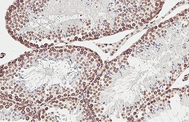 Anti-Lamin B1 antibody [HL3224] used in IHC (Paraffin sections) (IHC-P). GTX640865