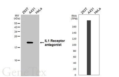 Anti-IL1 Receptor antagonist antibody [HL3228] used in Western Blot (WB). GTX640869