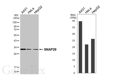Anti-SNAP29 antibody [HL3232] used in Western Blot (WB). GTX640873