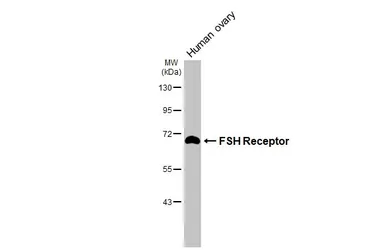 Anti-FSH Receptor antibody [HL3233] used in Western Blot (WB). GTX640874