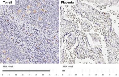 Anti-MMP9 antibody [HL3239] used in IHC (Paraffin sections) (IHC-P). GTX640882
