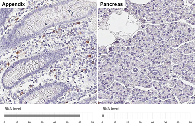 Anti-MMP9 antibody [HL3239] used in IHC (Paraffin sections) (IHC-P). GTX640882