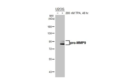 Anti-MMP9 antibody [HL3239] used in Western Blot (WB). GTX640882