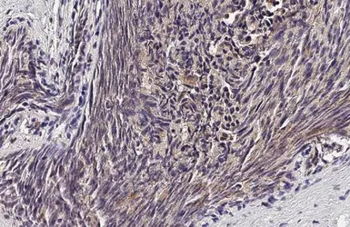 Anti-MMP9 antibody [HL3239] used in IHC (Paraffin sections) (IHC-P). GTX640882