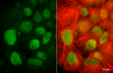Anti-TRIB3 antibody [HL3241] used in Immunocytochemistry/ Immunofluorescence (ICC/IF). GTX640884