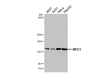 Anti-RFC1 antibody [HL3242] used in Western Blot (WB). GTX640885