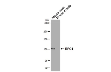 Anti-RFC1 antibody [HL3242] used in Western Blot (WB). GTX640885