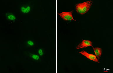 Anti-RFC1 antibody [HL3242] used in Immunocytochemistry/ Immunofluorescence (ICC/IF). GTX640885