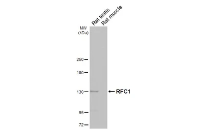 Anti-RFC1 antibody [HL3242] used in Western Blot (WB). GTX640885