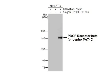 Anti-PDGF Receptor beta (phospho Tyr740) antibody [HL3244] used in Western Blot (WB). GTX640887