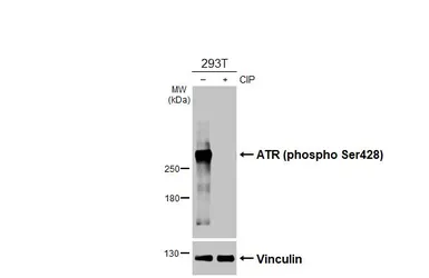 Anti-ATR (phospho Ser428) antibody [HL3246] used in Western Blot (WB). GTX640889