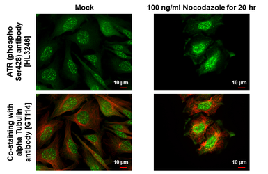 Anti-ATR (phospho Ser428) antibody [HL3246] used in Immunocytochemistry/ Immunofluorescence (ICC/IF). GTX640889