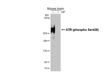 Anti-ATR (phospho Ser428) antibody [HL3246] used in Western Blot (WB). GTX640889