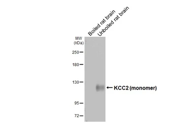 Anti-KCC2 antibody [GT16] used in Western Blot (WB). GTX640897