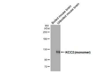 Anti-KCC2 antibody [GT16] used in Western Blot (WB). GTX640897