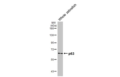 Anti-p63 antibody [HL3252] used in Western Blot (WB). GTX640899