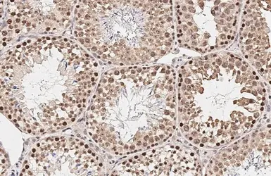 Anti-p63 antibody [HL3252] used in IHC (Paraffin sections) (IHC-P). GTX640899