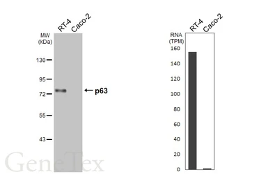 Anti-p63 antibody [HL3252] used in Western Blot (WB). GTX640899