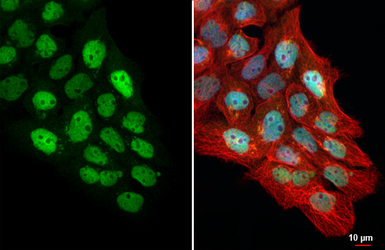 Anti-p63 antibody [HL3252] used in Immunocytochemistry/ Immunofluorescence (ICC/IF). GTX640899