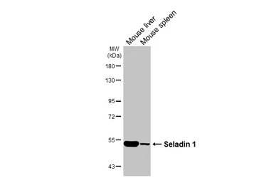 Anti-Seladin 1 antibody [HL3253] used in Western Blot (WB). GTX640900