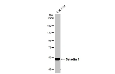 Anti-Seladin 1 antibody [HL3253] used in Western Blot (WB). GTX640900